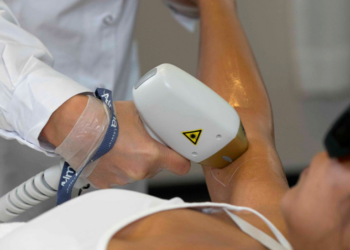 Estética não invasiva impulsiona depilação a laser
