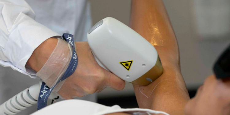 Estética não invasiva impulsiona depilação a laser