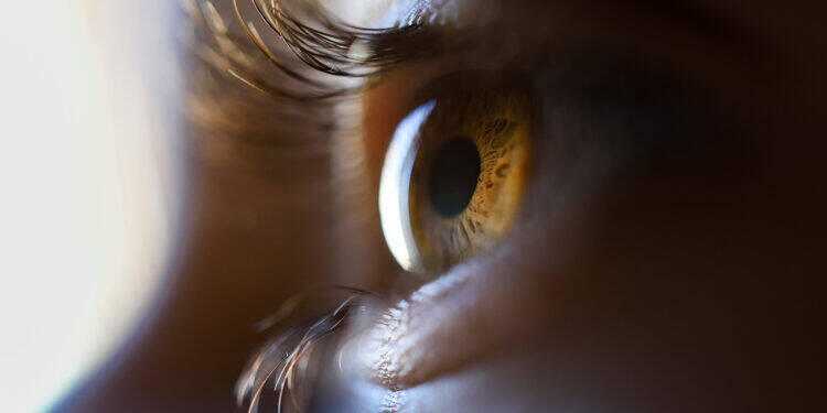 Tratamento para miopia corrige visão sem cirurgia invasiva