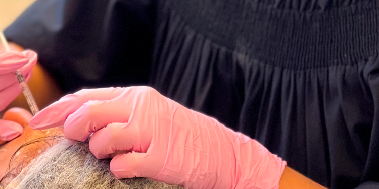 Biorremodelador tecidual é opção entre tratamentos estéticos