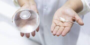 Especialista trata uso do balão intragástrico para emagrecer 3 Especialista trata uso do balão intragástrico para emagrecer