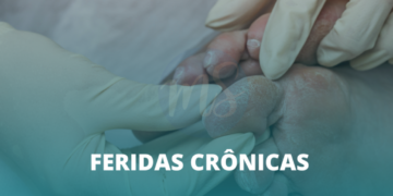 Estomaterapeuta trata ferida crônica e promove autocuidado eficaz