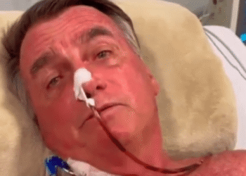 Bolsonaro apresenta piora na UTI: alterações hepáticas e hipertensão