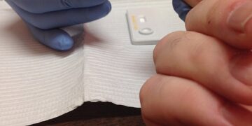 Ministério da Saúde prioriza novas tecnologias de prevenção ao HIV, mas incorporação ao SUS ainda não tem previsão