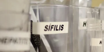 Sífilis mantém crescimento acelerado no Brasil, com impacto maior entre gestantes 15 Sífilis mantém crescimento acelerado no Brasil, com impacto maior entre gestantes