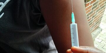 São Paulo confirma segundo caso de mpox do grupo lp no estado