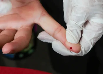 SUS passa a oferecer teste rápido para diagnóstico da dengue em todo o país