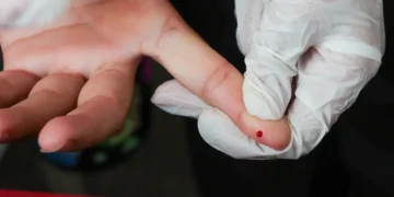 SUS passa a oferecer teste rápido para diagnóstico da dengue em todo o país 15 SUS passa a oferecer teste rápido para diagnóstico da dengue em todo o país