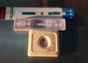 Fiocruz lança estudo inédito para ampliar prevenção ao HIV entre jovens em periferias