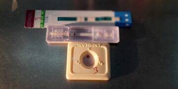 Fiocruz lança estudo inédito para ampliar prevenção ao HIV entre jovens em periferias 15 Fiocruz lança estudo inédito para ampliar prevenção ao HIV entre jovens em periferias