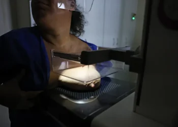 ANS propõe ampliar cobertura da mamografia digital para todas as idades e gêneros nos planos de saúde 18 ANS propõe ampliar cobertura da mamografia digital para todas as idades e gêneros nos planos de saúde