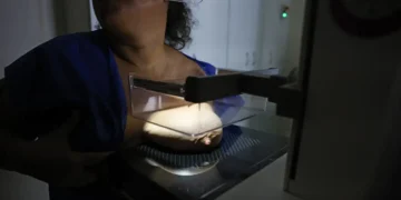 ANS propõe ampliar cobertura da mamografia digital para todas as idades e gêneros nos planos de saúde 15 ANS propõe ampliar cobertura da mamografia digital para todas as idades e gêneros nos planos de saúde